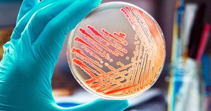 Microbiology